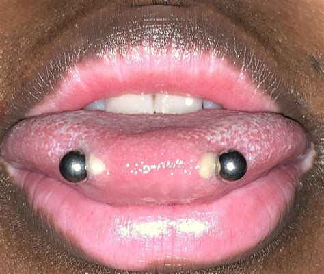 snake eyes piercing rejecting|Just got my snake eyes pierced, no pain but is this normal or rejecting ...